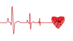 Cardiac Arrest: Understanding and Managing a Life-Threatening Emergency